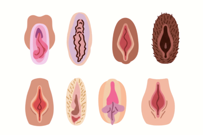 tipos de vagina